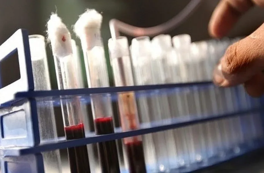 Измерват безплатно кръвната захар на кърджалийци