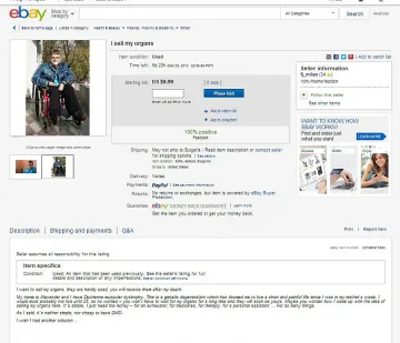 Обявата "органи за продан" - PR ход за болните от мускулна дистрофия