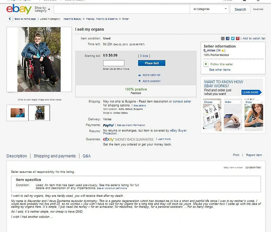 Обявата "органи за продан" - PR ход за болните от мускулна дистрофия