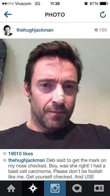 Хю Джакман се оперира от рак на кожата