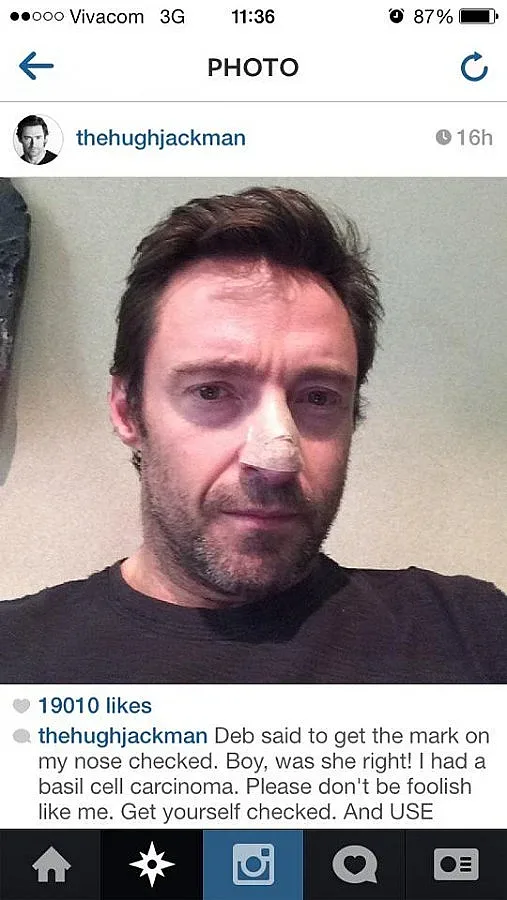 Хю Джакман се оперира от рак на кожата
