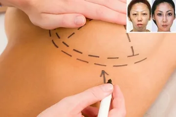 Китаец осъди жена си за $120,000 заради грозно бебе