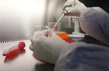 Засякоха опасен вирус в Испания