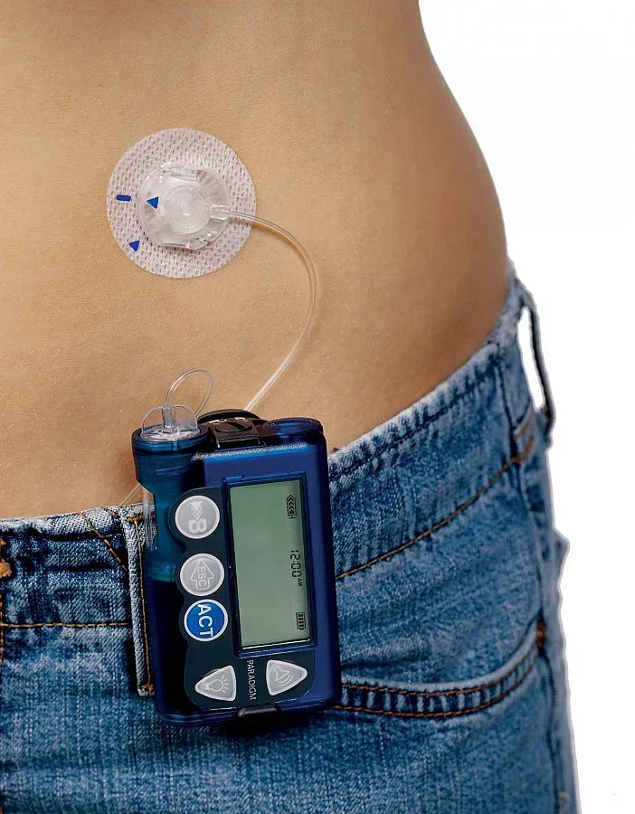 "Умна" помпа имитира панкреаса