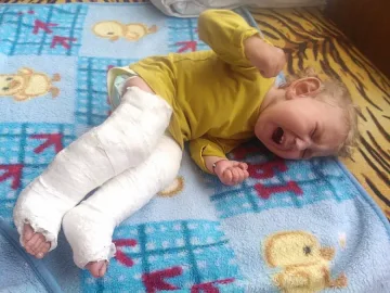 Бебе в гипс след масаж в Кюстендил