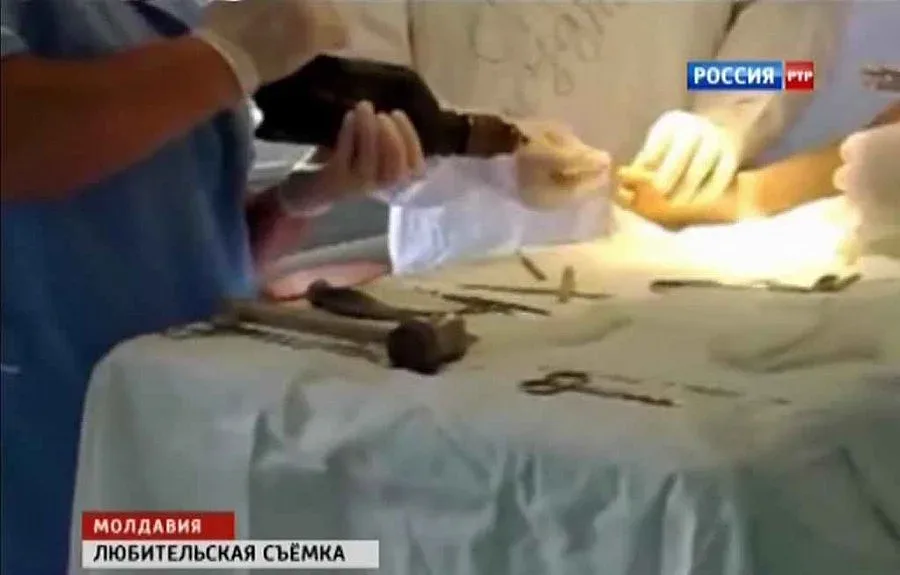 Операция с клещи шокира Молдова