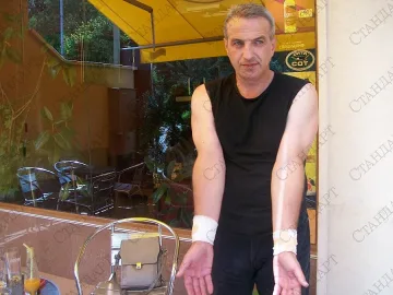 Полицаи оковаха и биха психиатър