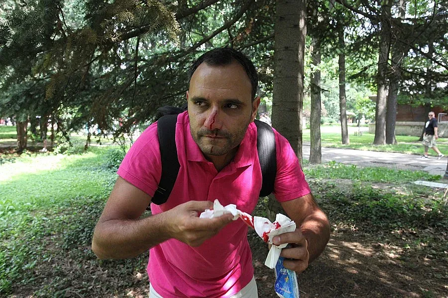 Кръв на протеста на ЦСКА