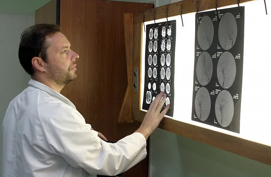 Главоболие, световъртеж и изтръпвания издават рядката деформация   