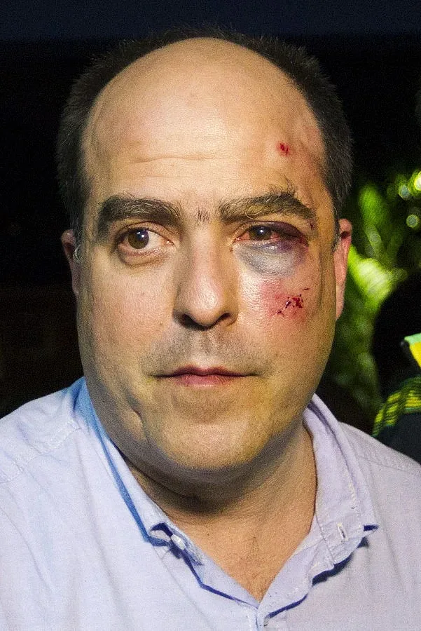 Депутати окървавиха парламента в Каракас