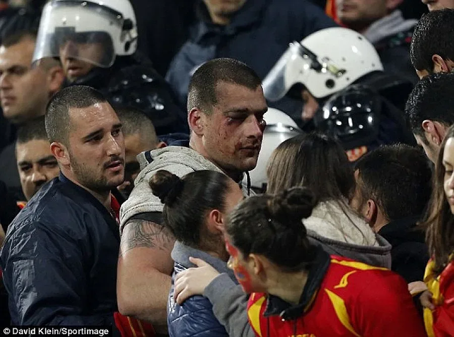 Бой и счупени глави преди мача на Англия