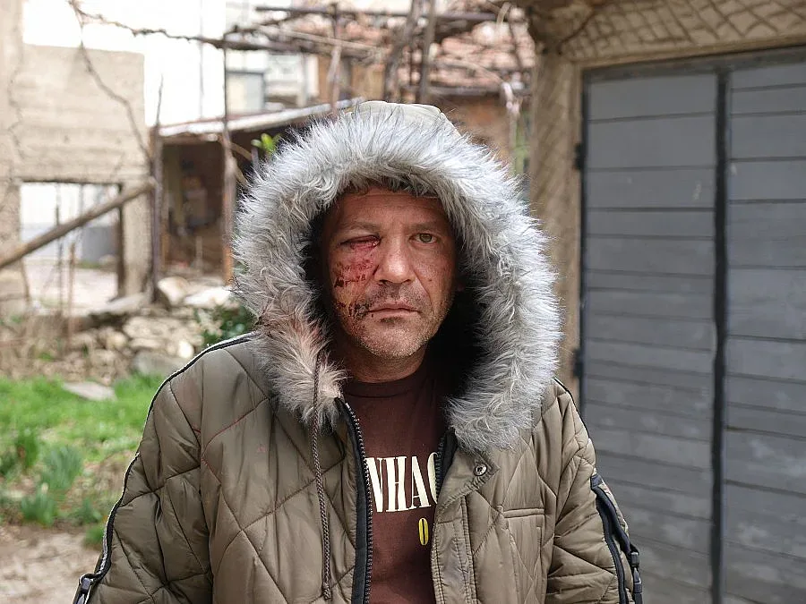 Комшия смаза от бой екоексперт