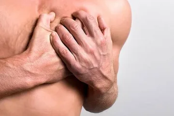 Инфаркт дебне ергените