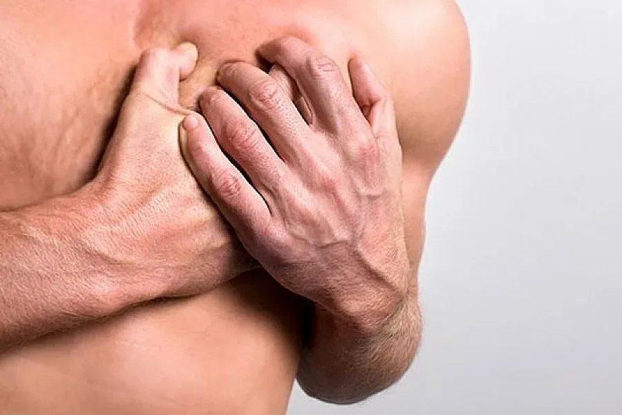 Инфаркт дебне ергените