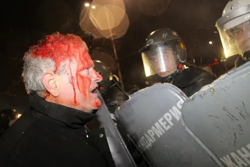 "Пирогов" се напълни с ранени