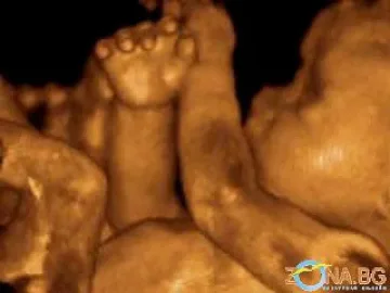 Болница с 4D ехограф в деня на любовта