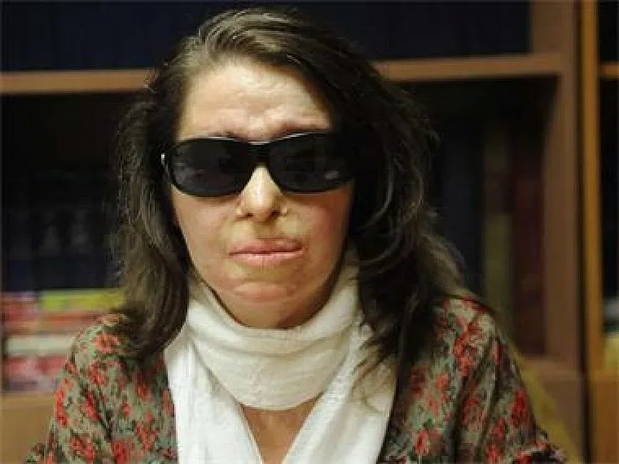 Покушението срещу Костадинка Кунева влиза в съд