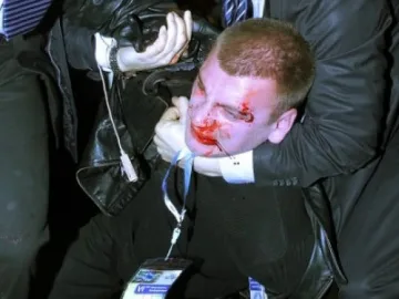 Патроните за Доган били сигнални