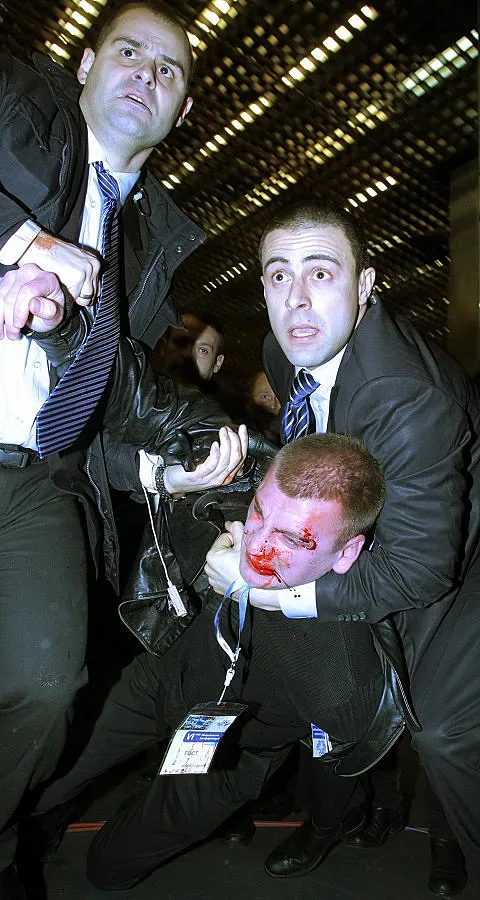 Нападателят се разминал с аркада на веждата