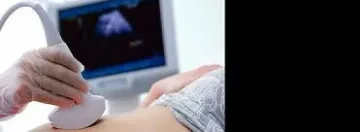 Пиле с ориз натрови 30 родилки