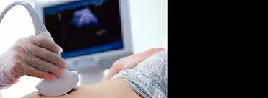 Пиле с ориз натрови 30 родилки