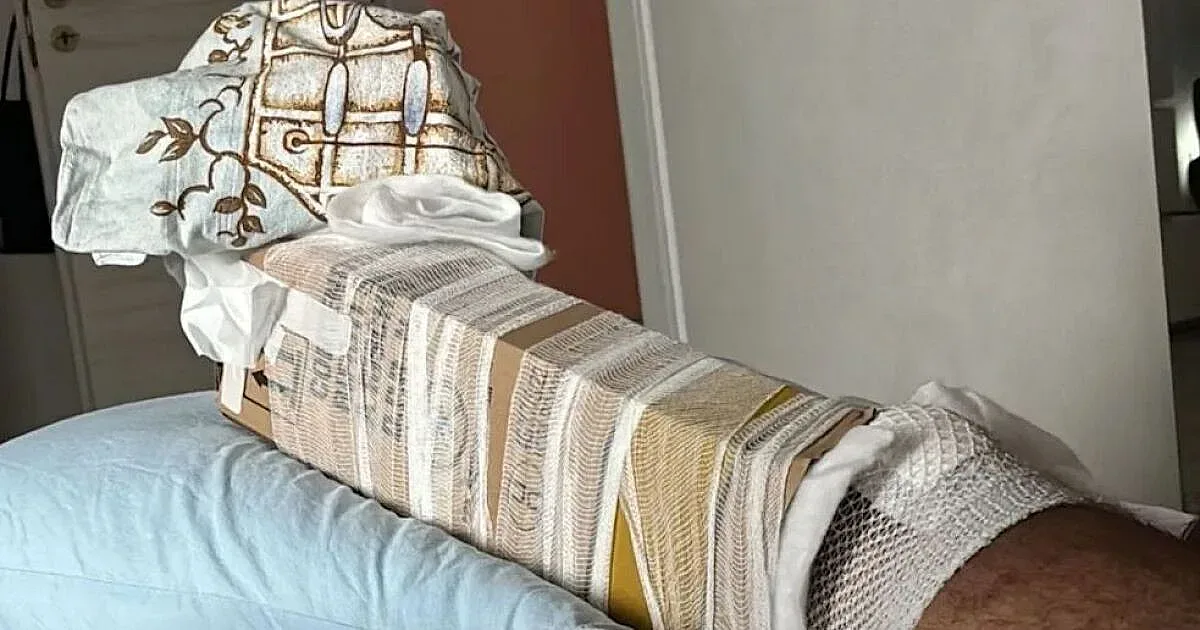 Картон вместо гипс! Болница хвърли в ужас потрошен пациент