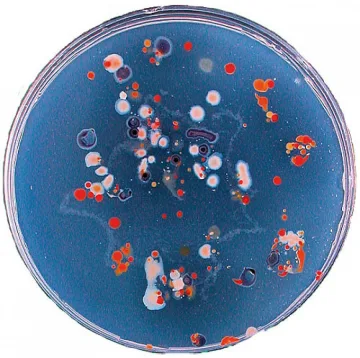 Борят инфекции с "оръжие" за 1 млн.