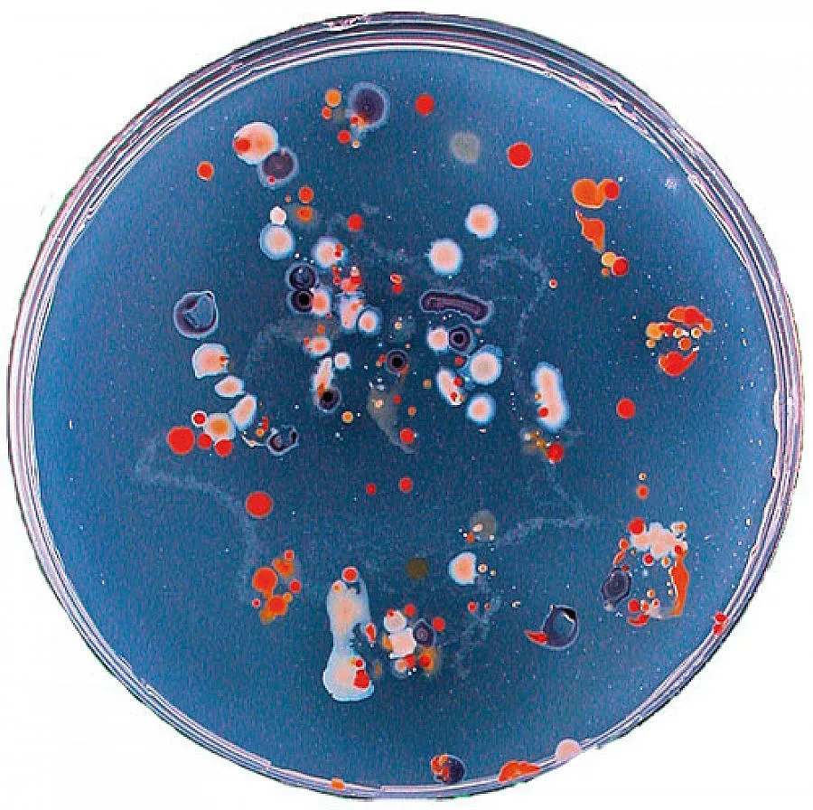 Борят инфекции с "оръжие" за 1 млн.