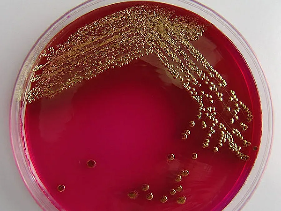 Туршия с Ешерихия коли уби шестима