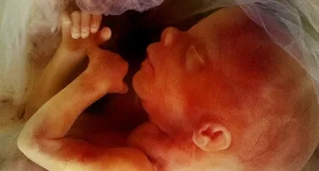 Разкриха мръсен бизнес с ембриони в Русия