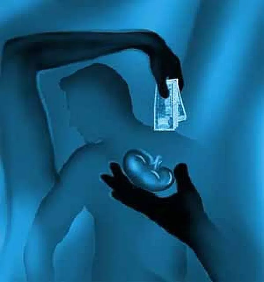 Продават бъбреци по 30 000 евро в нета