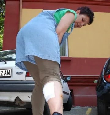 Освирепели помияри наръфаха жена