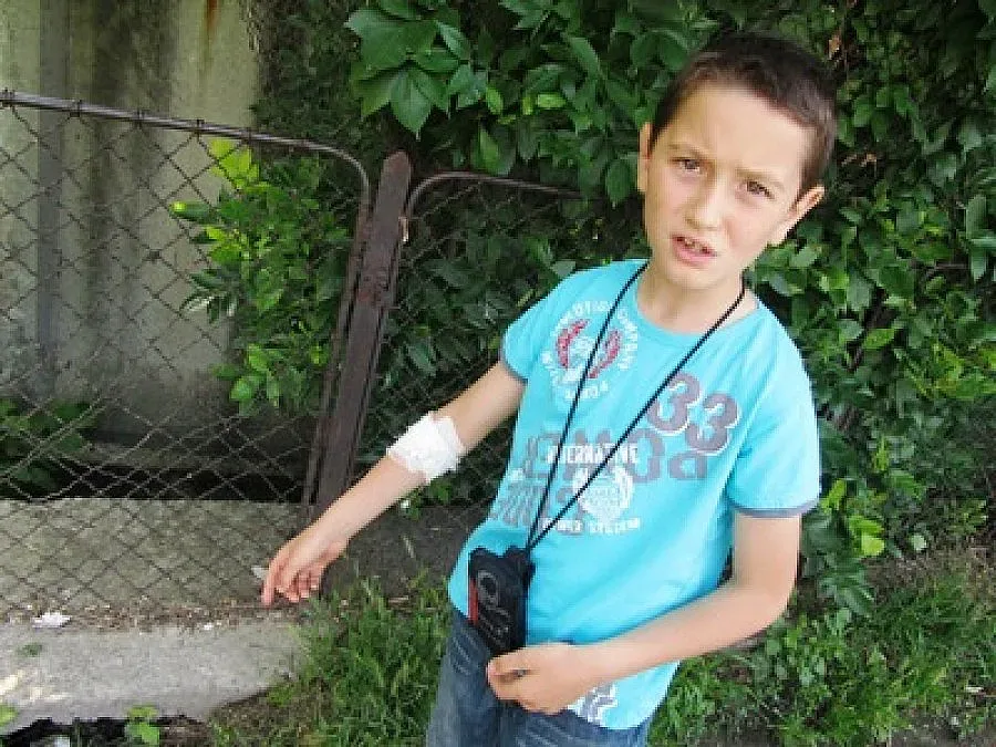 Змия клъвна дете в школо