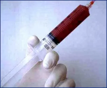 Крадец обира с игла със СПИН