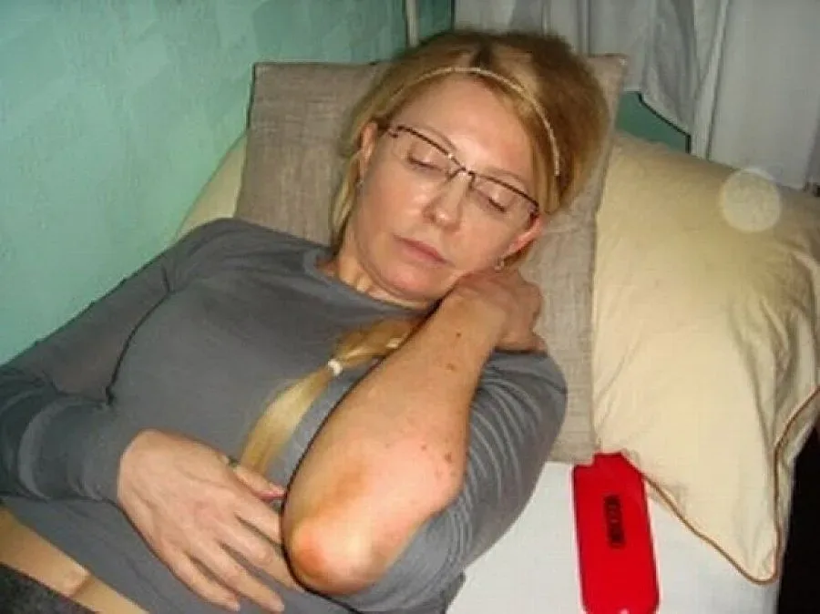 Украйна не пуска Тимошенко за лечение в чужбина