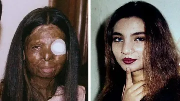 Залята с киселина от съпруга си скочи от шестия етаж