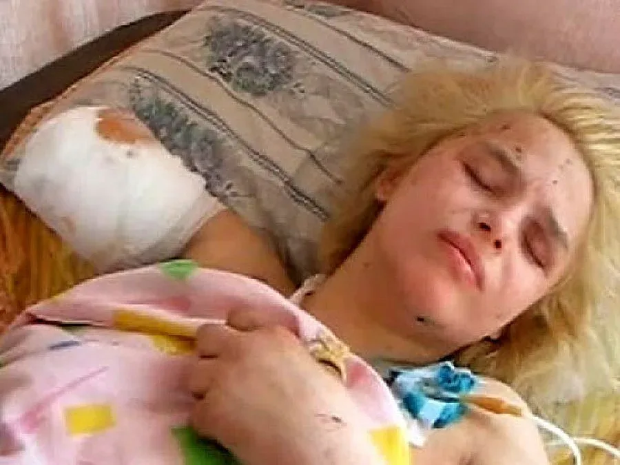 Почина момиче на 18, зверски изнасилено и подпалено