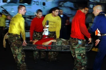 Безработен си отряза крака, за да не работи