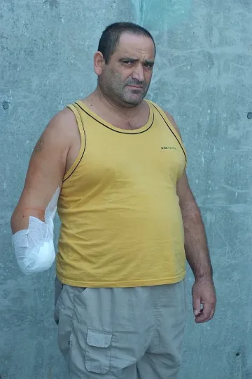 Без глоба за отрязана ръка