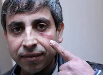 Скинари млатиха ромски поет