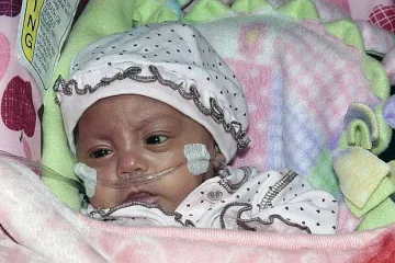 Изписаха с фанфари бебе, родило се 269 грама