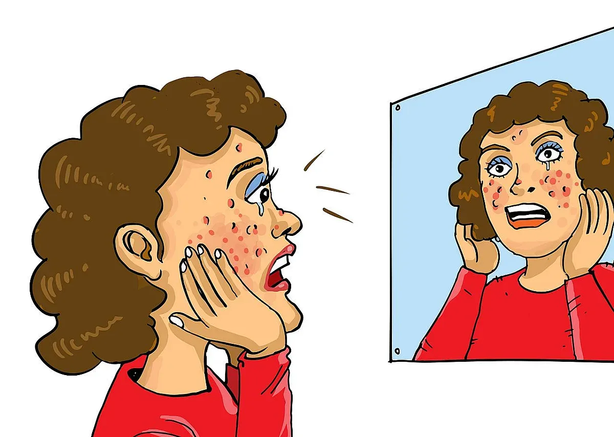 Стана ясна най-добрата диета за борба с акнето