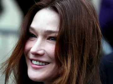 Мадона и Карла прекалили с пластиката