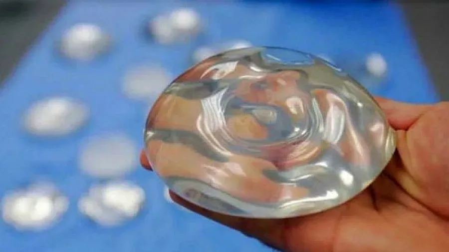 Съветват французойките да махнат силикона