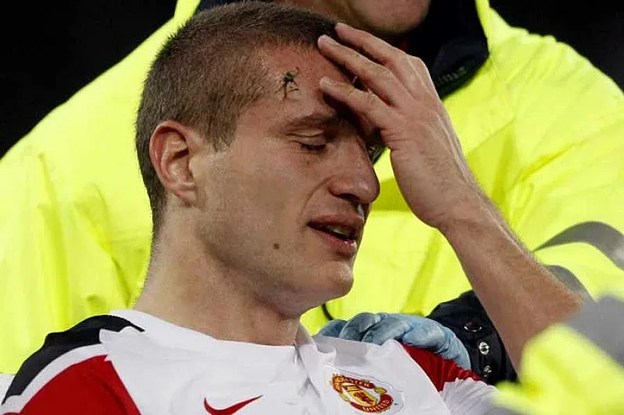 Видич тежко контузен - аут най-малко 4 месеца