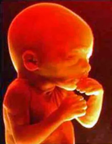 АГ шеф научил последен за умряло бебе