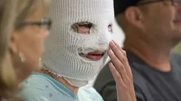 26 жени обезобразени с киселина за година