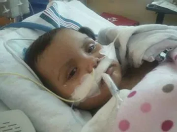 Дават 10 млн. долара на момиче с ампутирани крайници 