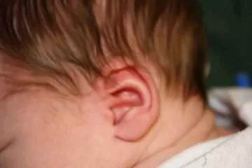 Вирус удря хлапета в ухото
