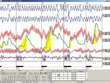 Искат детектор на лъжата за кандидат-кметовете